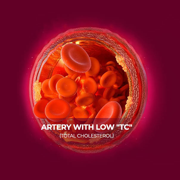 low-tc-total-cholesterol-MB